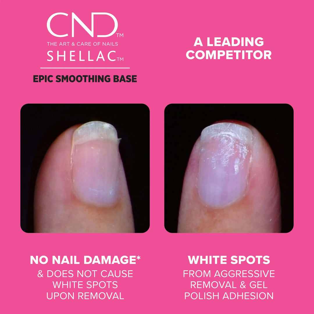 Comparison of nail health with CND Shellac and a leading competitor on a pink background. The nail treated with CND seems healthier with no nail damage and does not cause white spots upon removal. The nail featuring the leading competitor has numerous white spots from aggressive removal and gel polish adhesion.